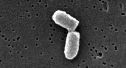 E. Coli bacterium dividing. Image: CDC / Evangeline Sowers, Janice Haney Carr€